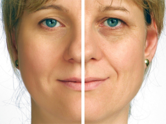 5 Factors that Contribute to Fast Skin-Aging